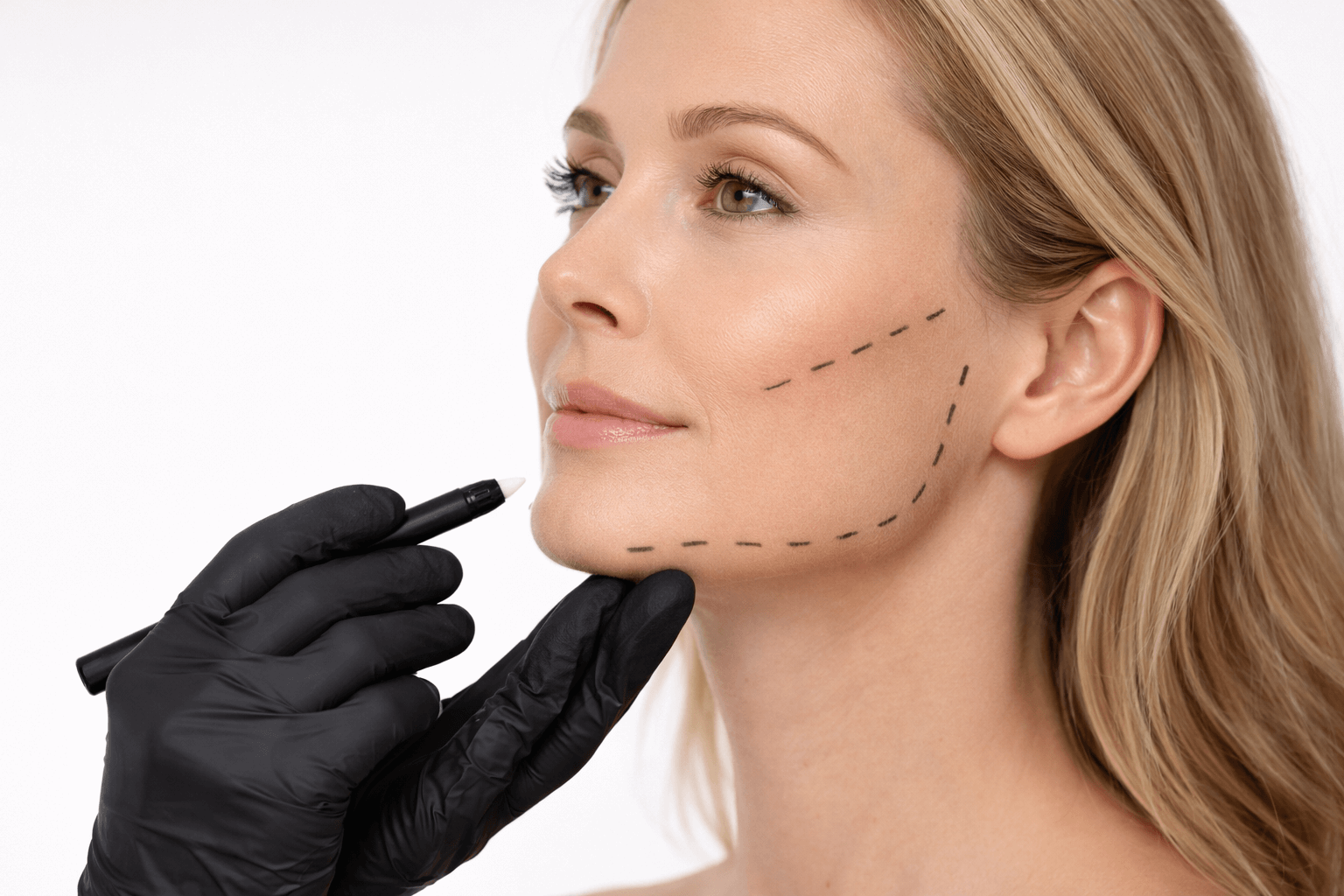 Tratamiento de armonización facial mediante ácido hialurónico para mejorar pómulos, mentón y contorno mandibular. Este procedimiento de medicina estética busca corregir desequilibrios faciales y potenciar la simetría respetando los rasgos naturales. Armonización facial personalizada en la zona norte de Madrid.